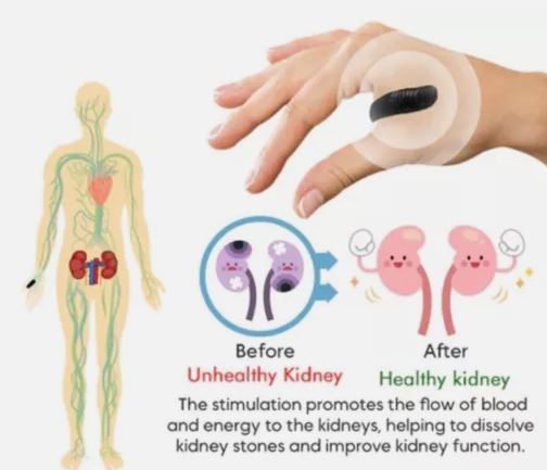 Sugar Control LI4 Acupressure Point Clip (Magnetic)